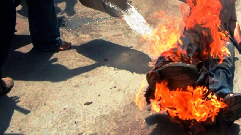 Algérie-Chômage : Un jeune de 23 ans  s’immole par le feu à Mascara